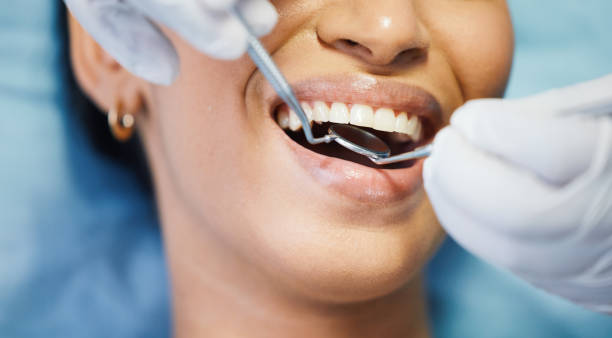 Best Emergency Treatment for Dental Infections or Abscesses in Punxsutawney, PA